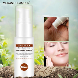 VIBRANT GLAMOUR Crocodile Face Serum Spray Toner Removal Scars  Shrink Pores Repair Acne Scar Marks Relieve Sensitive Face Care
